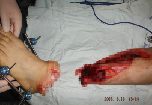 <a href='http://m.globaltechresearch.com/' target='_blank'><u>徐州仁慈醫(yī)院</u></a>